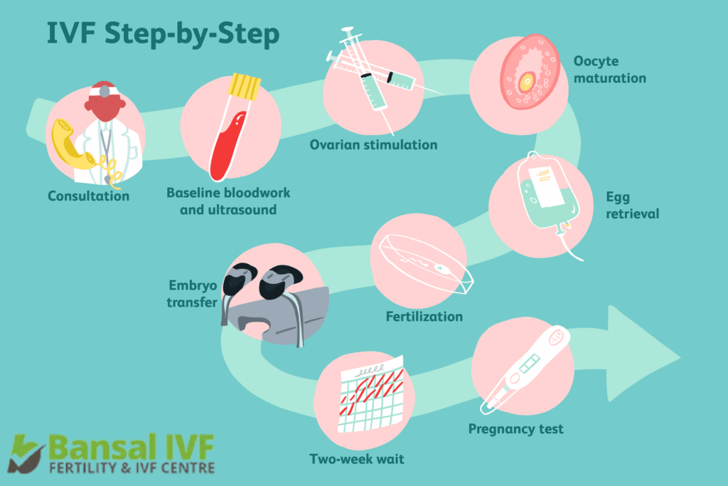 In-Vitro Fertilization