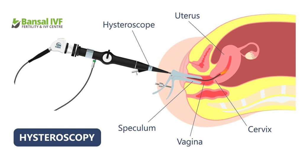 Hysteroscopy