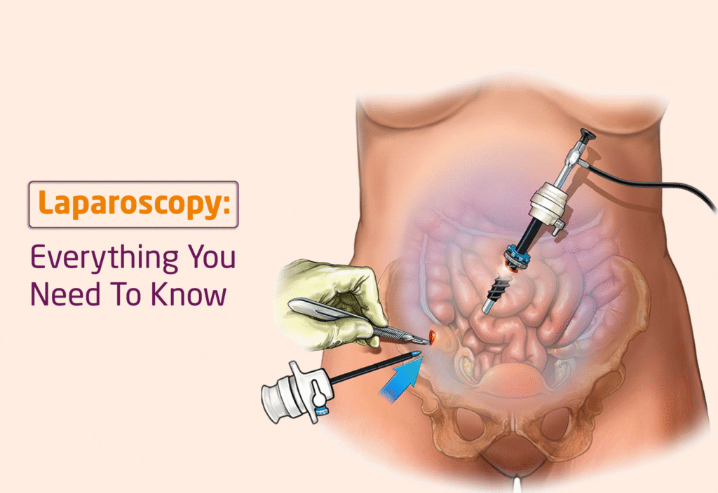 laparoscopy
