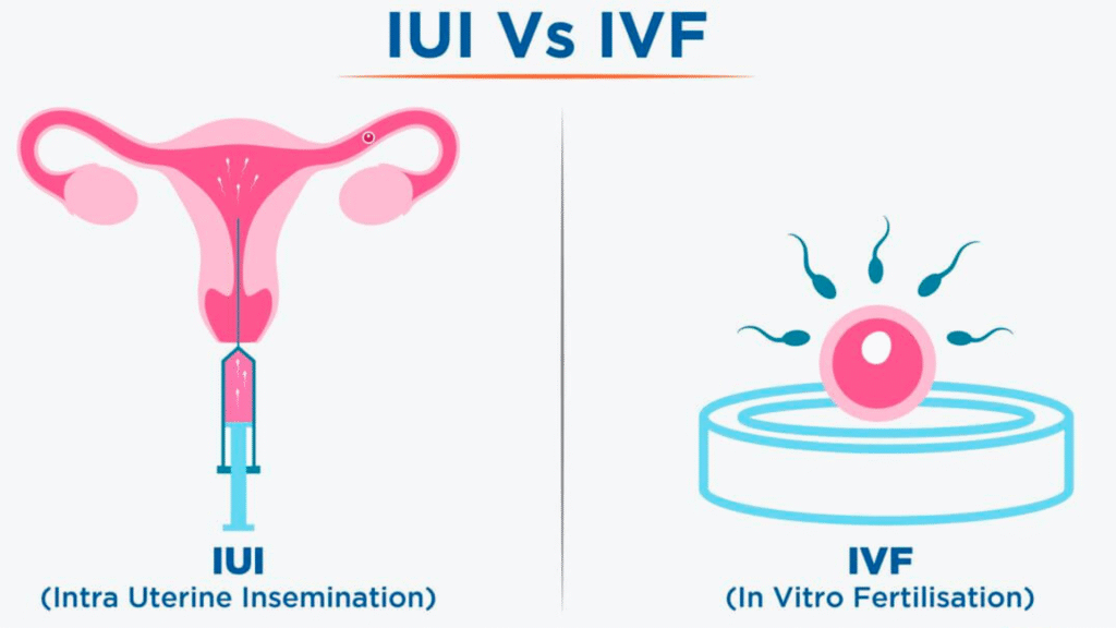 IVF-Hospital-Narela