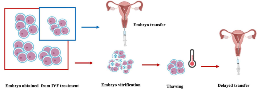Egg-Freezing-vs-Embryo-Freezing