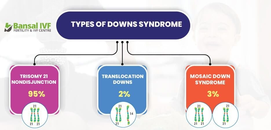 Types-of-Down-Syndrome