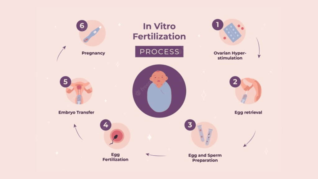IVF-Treatment
