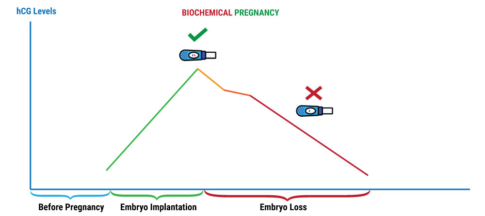 Biochemical-Pregnancy