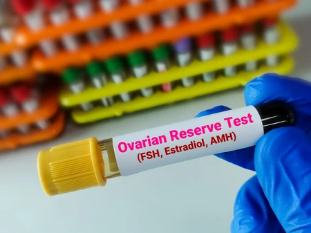 ovarian-reserve